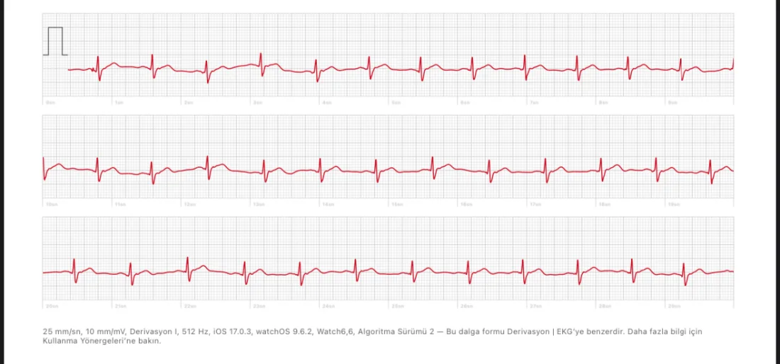 Akıllı Saatlerde EKG Nasıl Çalışır?